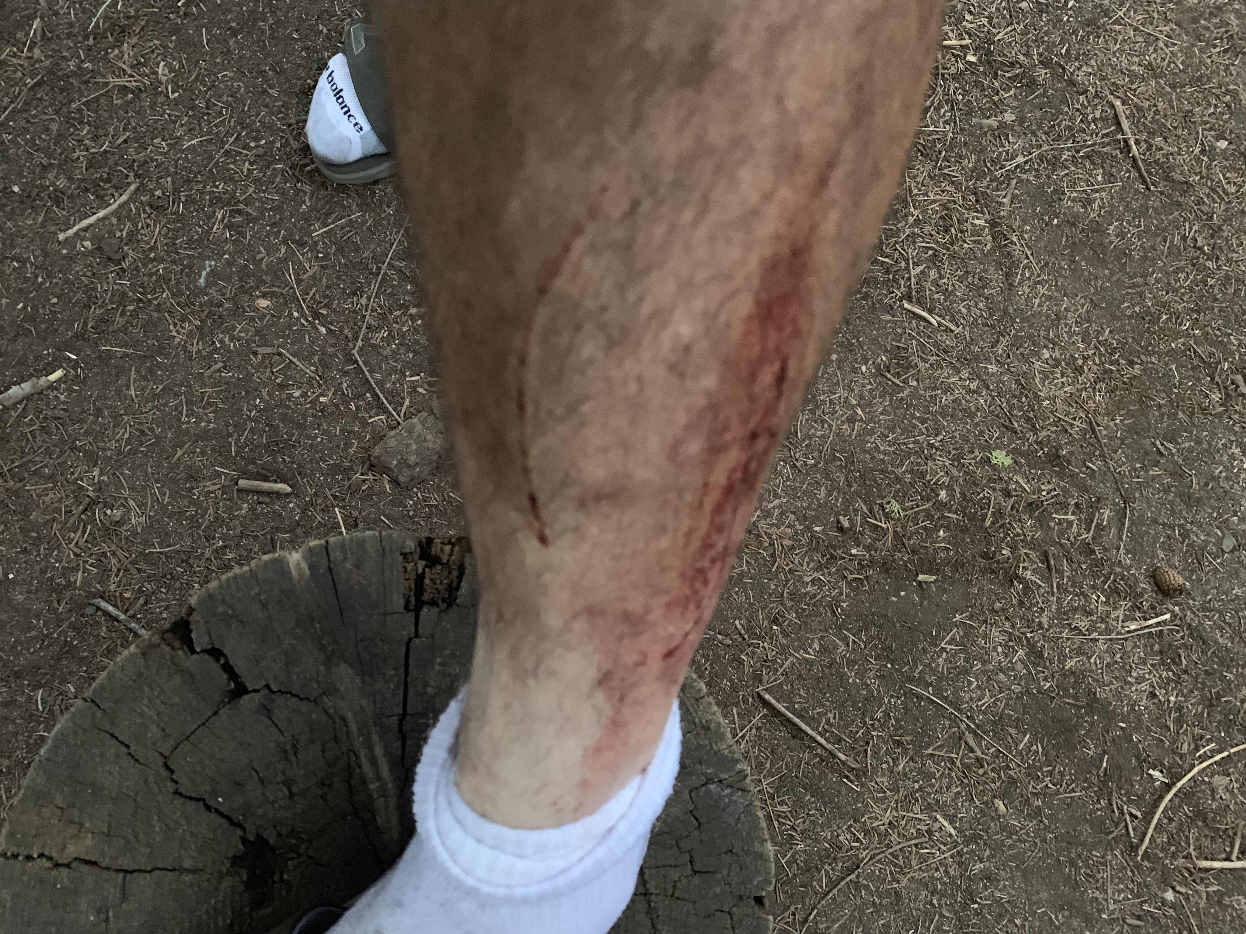 [Image: bloodyleg.jpg]